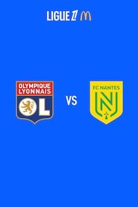 리옹 vs 낭트