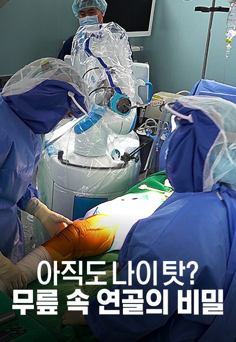 채널A 특별기획 아직도 나이 탓? 무릎 속 연골의 비밀