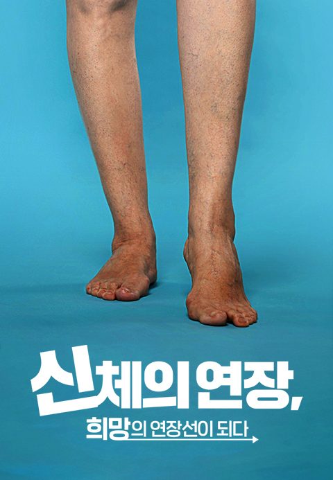 신체의 연장, 희망의 연장선이 되다